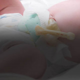 What is Delayed Umbilical Cord Clamping?
