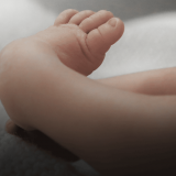 What is Clubfoot and What Can I Do About It?