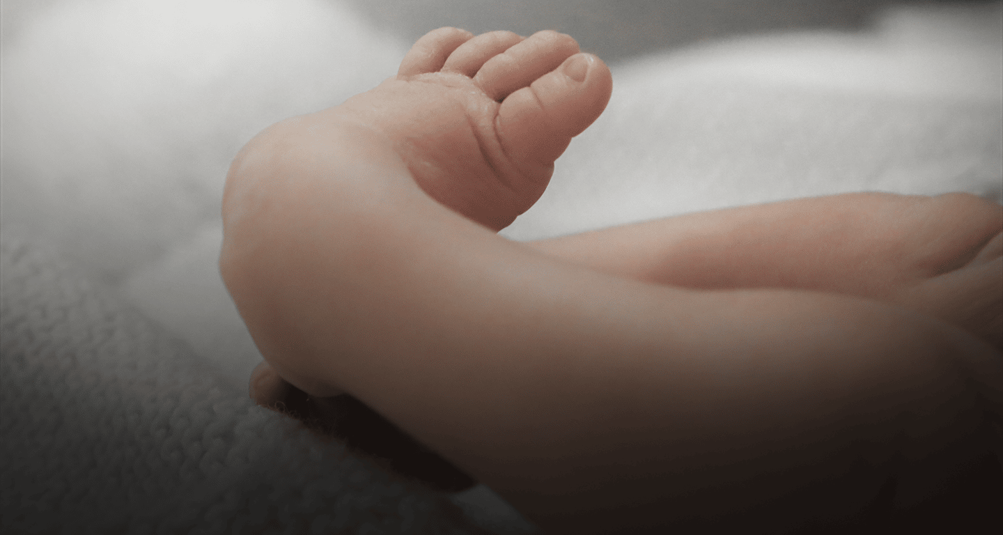 What is Clubfoot and What Can I Do About It?