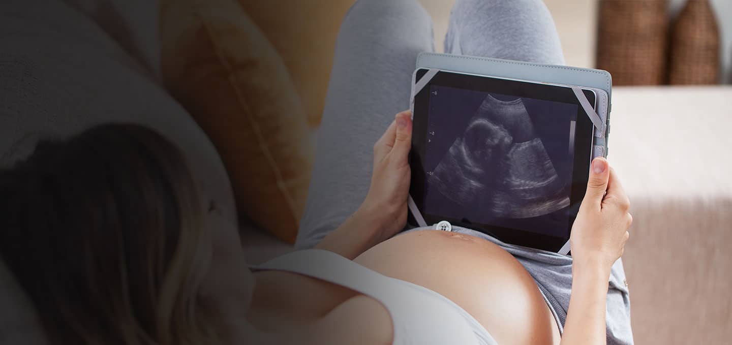 Expectant mother holding a tablet showing her pregnancy ultrasound image, Carnegie Imaging for Women NYC